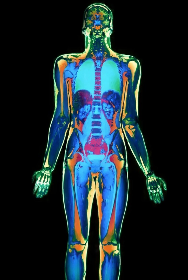 DEXA Body Composition Scan